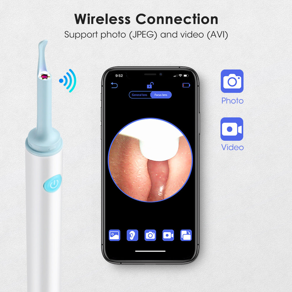 Wireless Ear Wax Removal